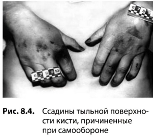 http://forum4.ru/uploads/001a/f5/a1/2/304721.jpg