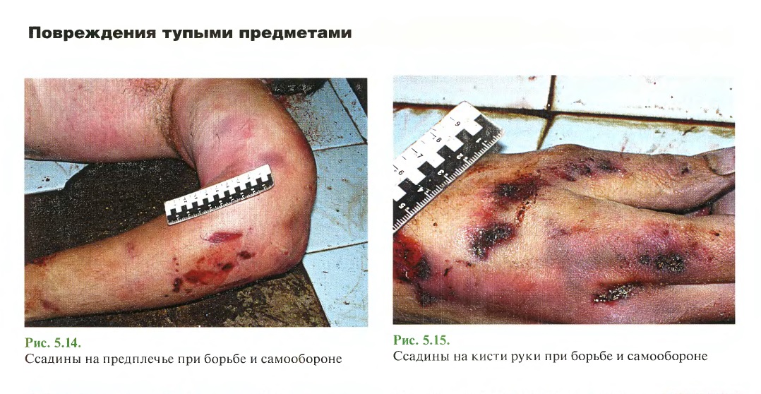 http://forum4.ru/uploads/001a/f5/a1/2/517326.jpg
