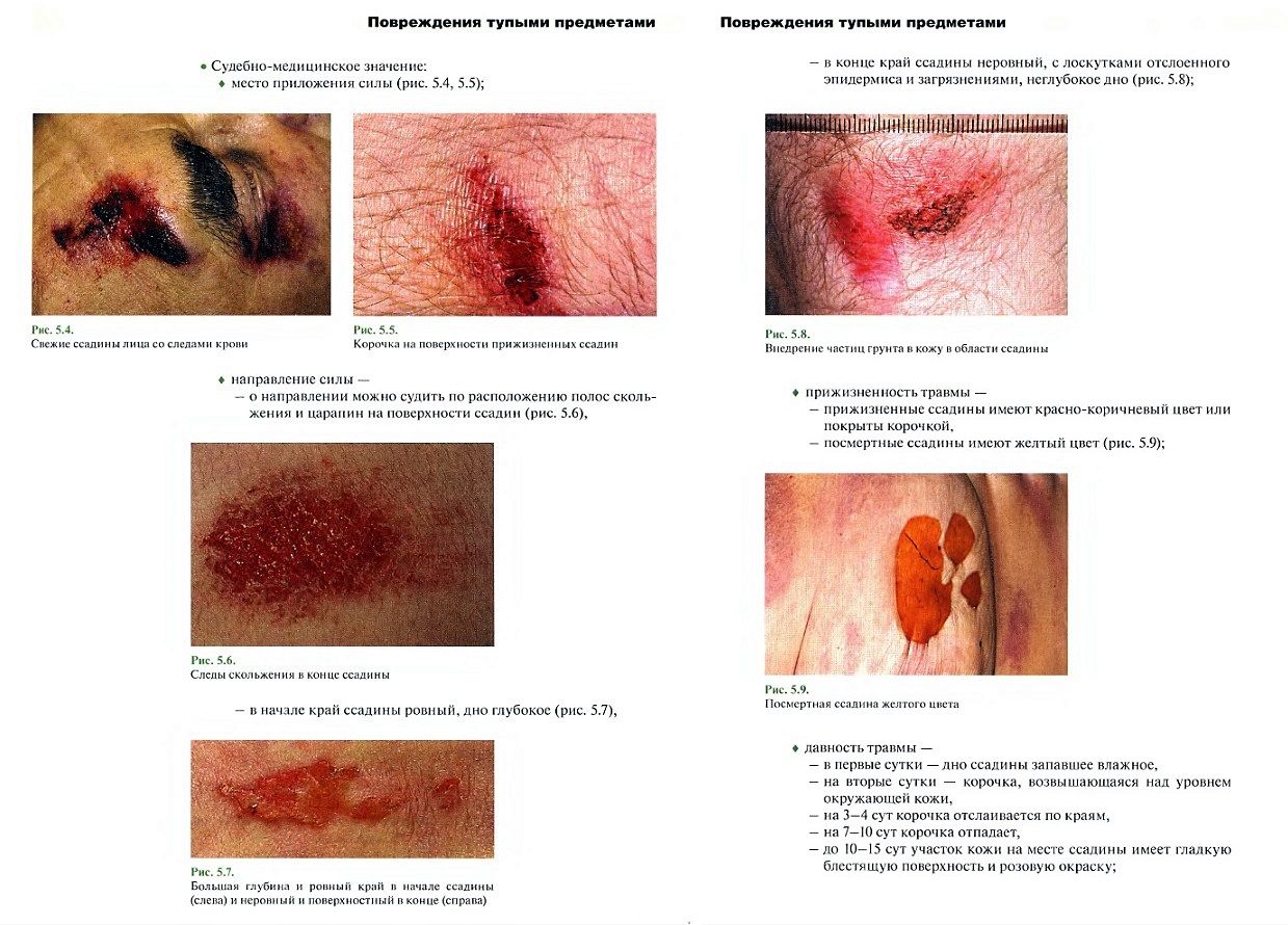 http://forum4.ru/uploads/001a/f5/a1/2/582296.jpg