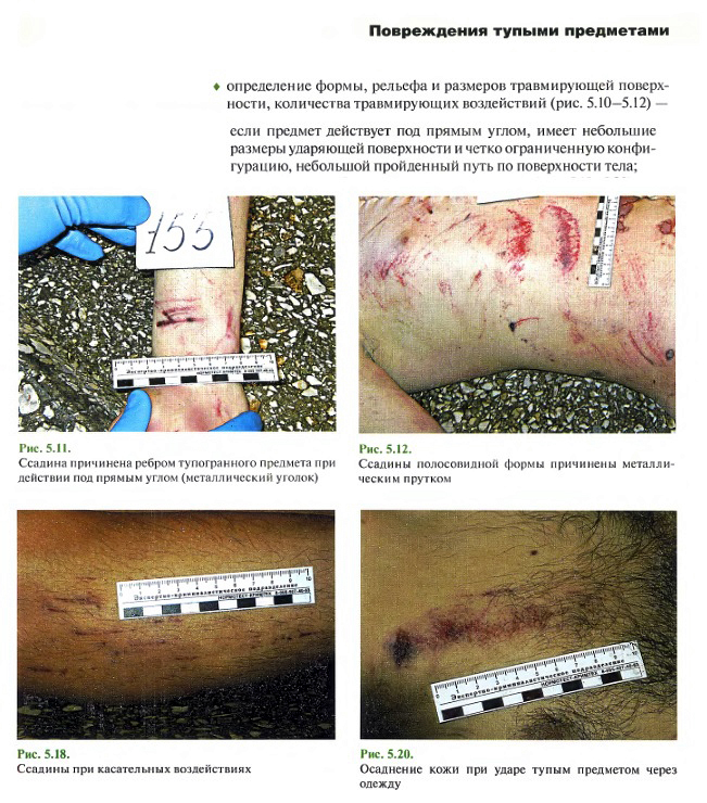 http://forum4.ru/uploads/001a/f5/a1/2/929554.jpg